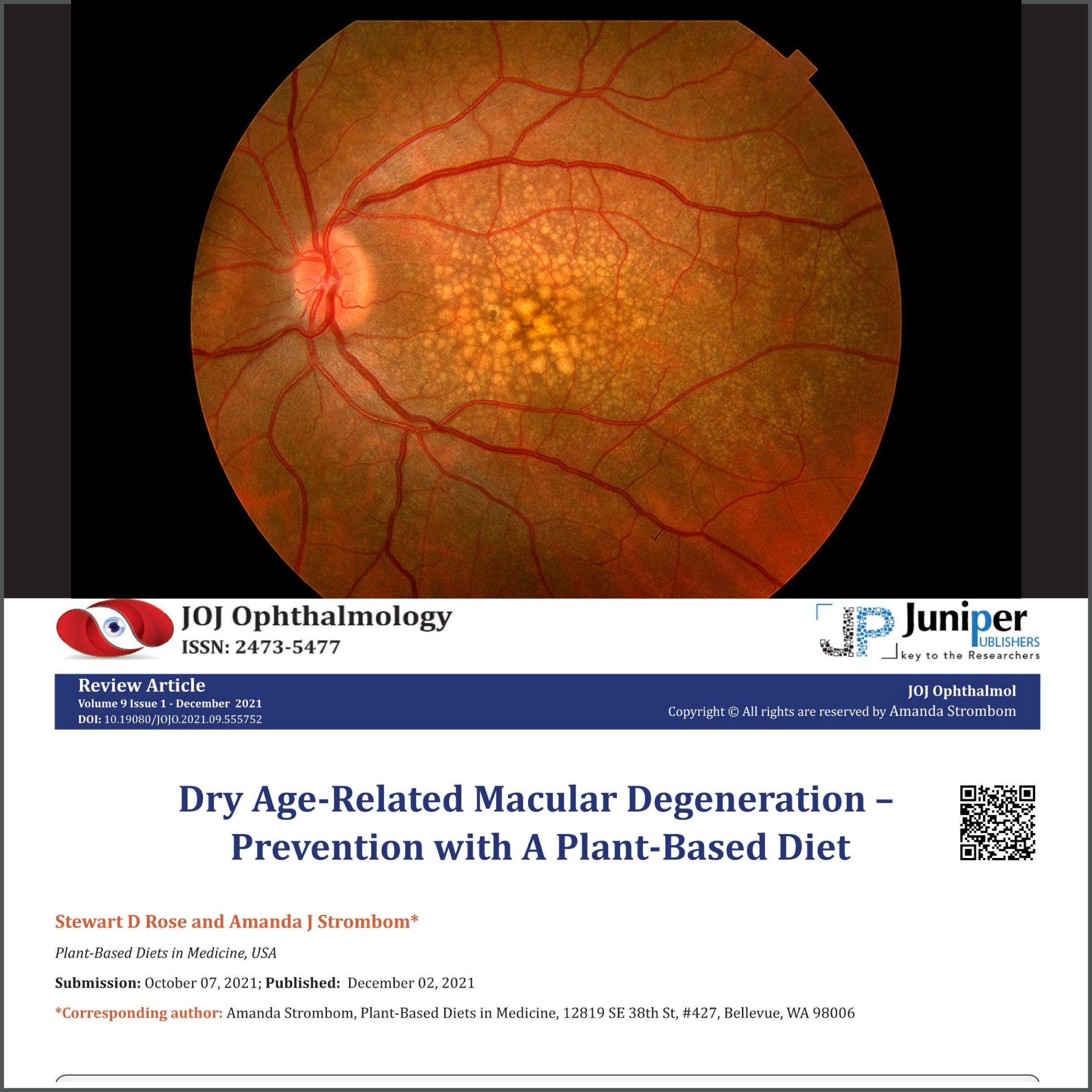 Dry AgeRelated Macular Degeneration Prevention with a plantbased