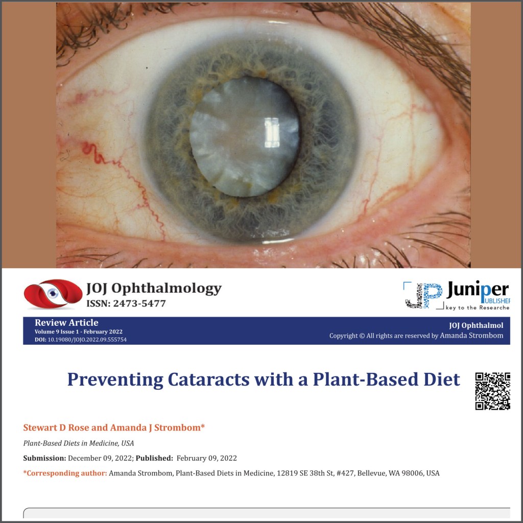 Eye with cataract, over article header