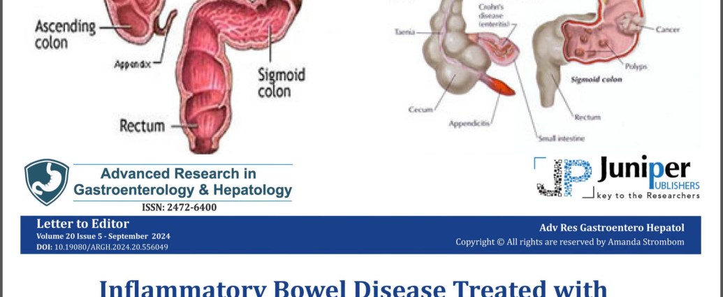 Image of healthy and diseased colons, combined with article header